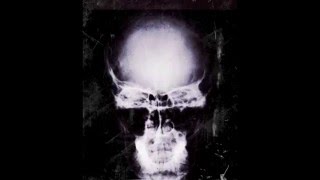 Suicide Commando - Only The Mind Will Suffer