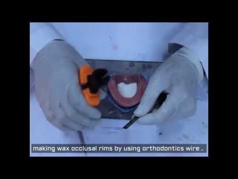 new method to make wax occlusal rim for record blo