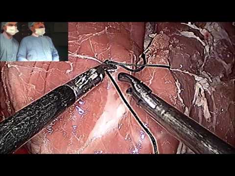 Clase magistral de demostración de nudo cuadrado laparoscópica