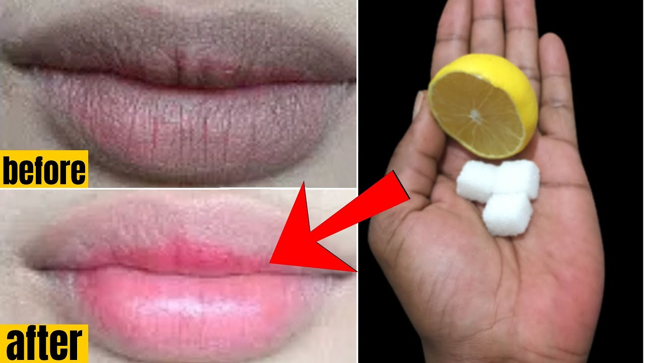 Comment transformer les lèvres sombres, rugueuses et sèches en rose tendre en trois minutes naturell