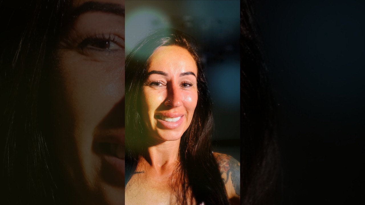 Laminate Veneer – BL2 -Natural Style - Video