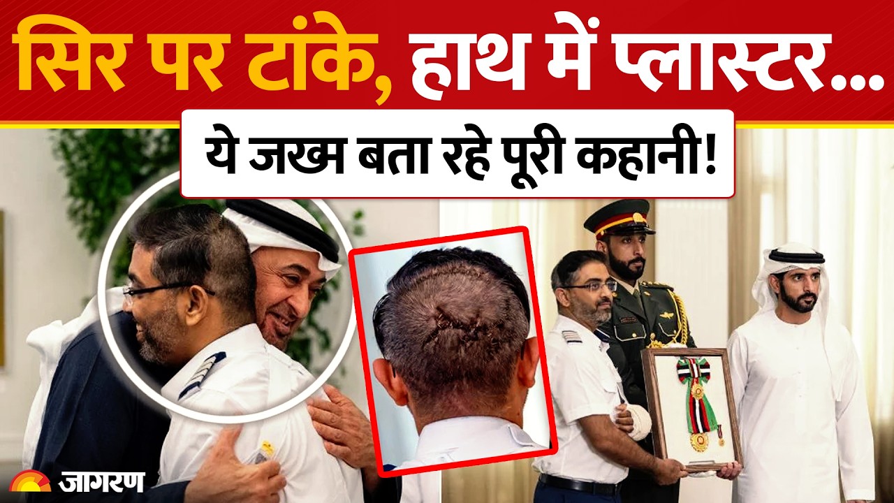 Captain Smit Machchhar Video: कैप्टन स्मित के जख्म ने बताई पूरी कहानी | Flydubai | Saudi Arabia