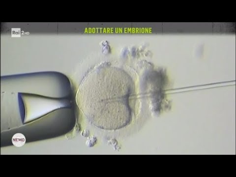 Potassio e magnesio per la potenza La cura più efficace per la potenza