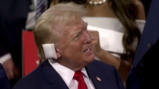 [問卦] 川普耳朵一包心理陰影面積不大？