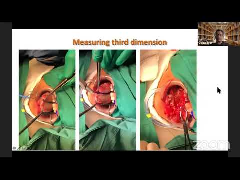 Advanced Head and Neck Cancer Webinar 2020