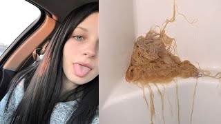 Teen Melts Off Her Hair With Bleach