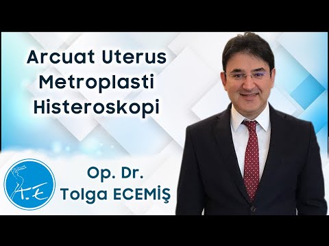 Arkuat Uterus Metroplasti Histeroskopi