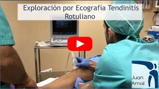 TENDINITIS CRÓNICA DEL ROTULIANO: ECOGRAFÍA DE NEO-VASCULARIZACIÓN