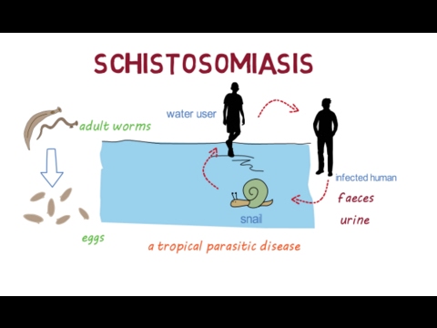 schistosomiasis természetes kezelés
