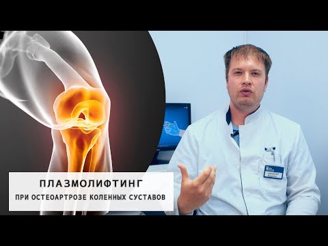 Ce vindecătorii tratează artrita