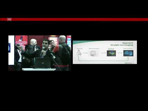 University of Alabama Birmingham - Accelerating Parkinson's Research