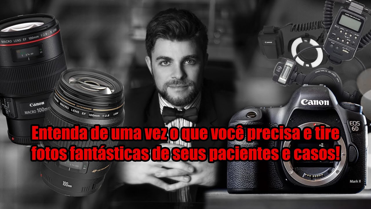 FOTOGRAFIA NA ODONTOLOGIA - Não compre nada sem ver esse vídeo!