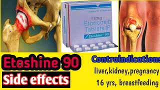 Etoshine 90 tablet/ अगर आपको एलर्जी है etoricoxib से तो ज़रूर देखें।
