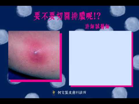 長釘子如何處理