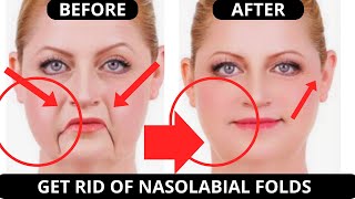 🛑 LAUGH LINES FACIAL EXERCISES (NASOLABIAL FOLDS) | JOWSL | ANTI-AGING EXERCISES FOR WRINKLES