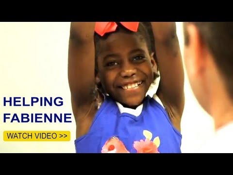 Helping Fabienne : Dr. Cederna and reconstructive burn surgery | Frankel Cardiovascular Center | Michigan Medicine->