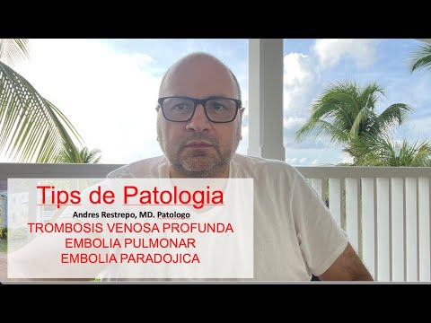 TROMBOSIS VENOSA PROFUNDA, EMBOLISMO PULMONAR, EMBOLIA PARADOJICA. Andres Restrepo. MD. Patologo.