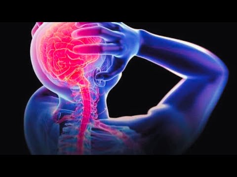 Astaamaha Xanuunada Neerfaha | neerfaha madaxa | neerfaha lugaha