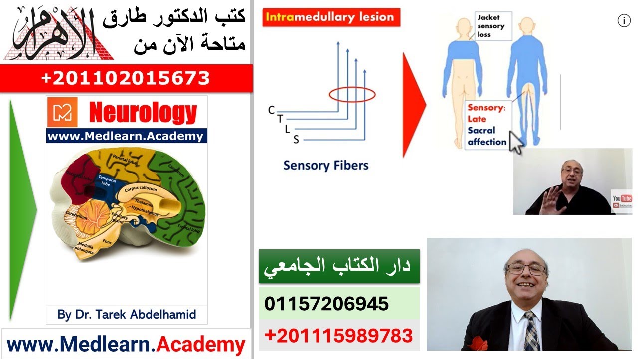 Localization of Neurological Lesions (Part 3)
