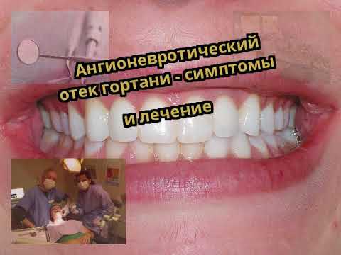 Спондилез грудного отдела позвоночника с нарушением статики Лечение растяжения голеностопного сустава народными средствами