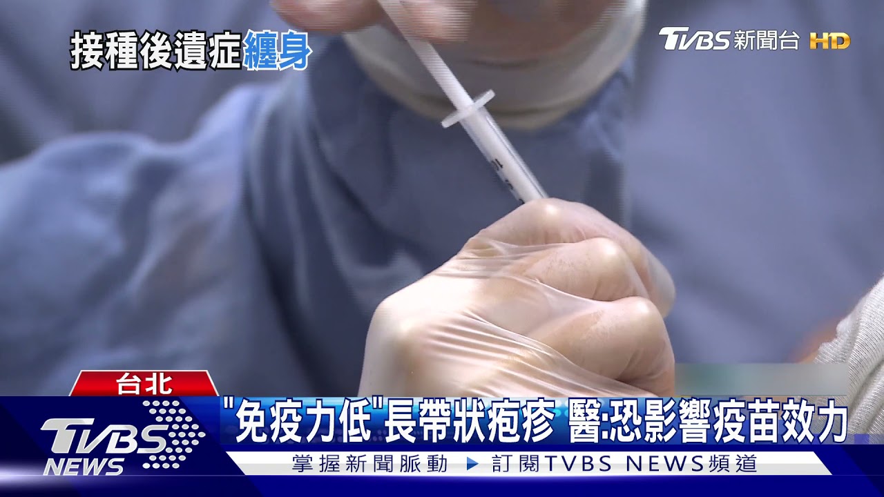 打疫苗後冒「帶狀疱疹」　醫師：時序重複、無關聯