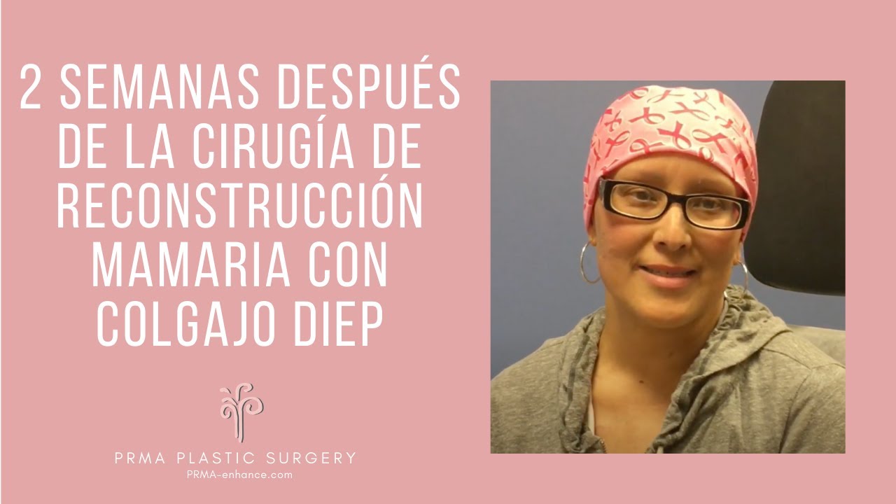 2 semanas después de la cirugía de reconstrucción mamaria con colgajo DIEP