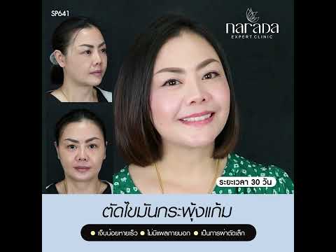 ปรับรูปหน้าทำให้ใบหน้าเรียวเล็กลง ด้วยการผ่าตัดกระพุ้งแก้ม Buccal Fat Removal Program   ปรับรูปหน้าทำให้ใบหน้าเรียวเล็กลง ด้วยการผ่าตัดกระพุ้งแก้ม Buccal Fat Removal Program