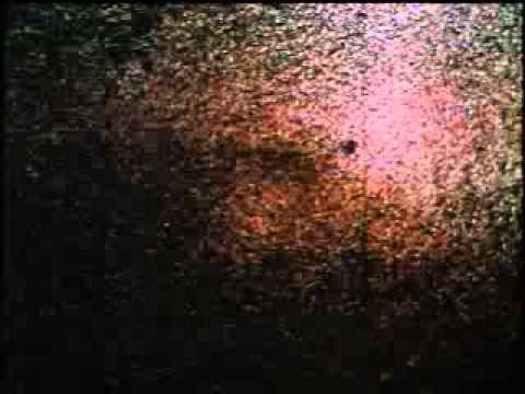 Psych-Burn