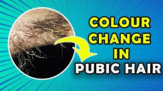Get rid of colour change in pubic hair and under arm hair (Trichomycosis)