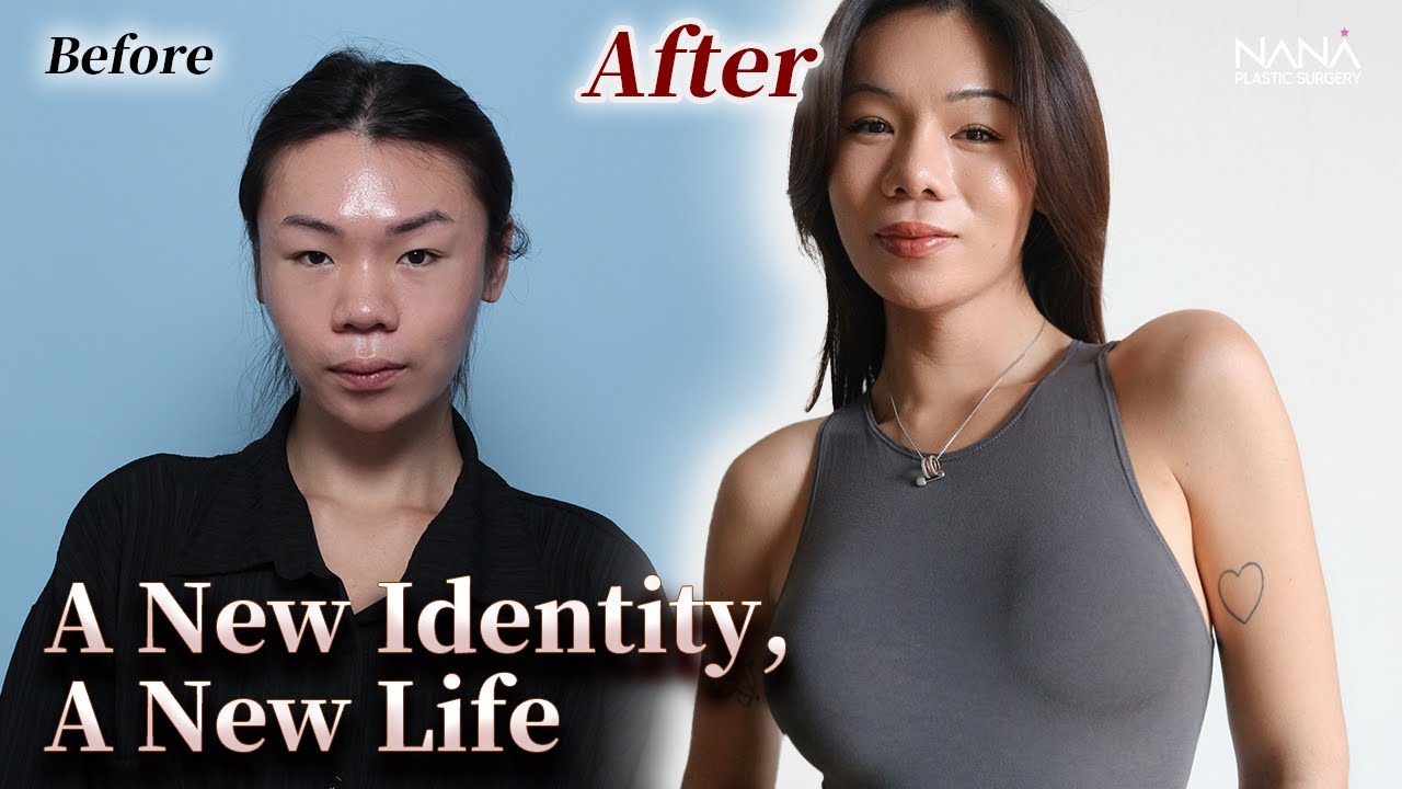 NANA Plastic Surgery patient review beauty transformation in South Korea YouTube video