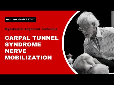 Myoskeletal Alignment Techniques: Median Nerve Mobilization and Carpal Tunnel Syndrome