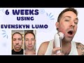 Clinically Proven Aging Reverser EvenSkyn Lumo Anti Aging Device At Home