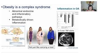 Innovations in OA Treatment