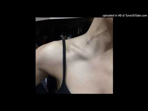 (2016)(Unreleased)XXXTENTACION- Lynch  Prod.Prxz & The Virus And Antidote)