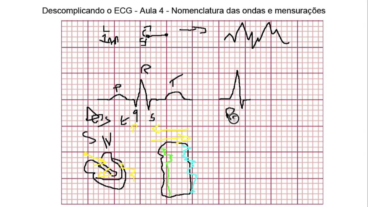Descomplicando o ECG - Aula 4 - Nomenclatura e mensuração de ondas