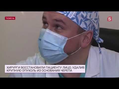 Нейрохирурги Центра Алмазова помогли коллегам в Тюмени спасти пациента