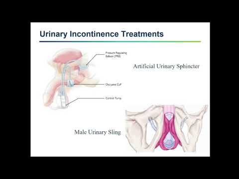 2018 IPCR Symposium Session 1 Talk 5
