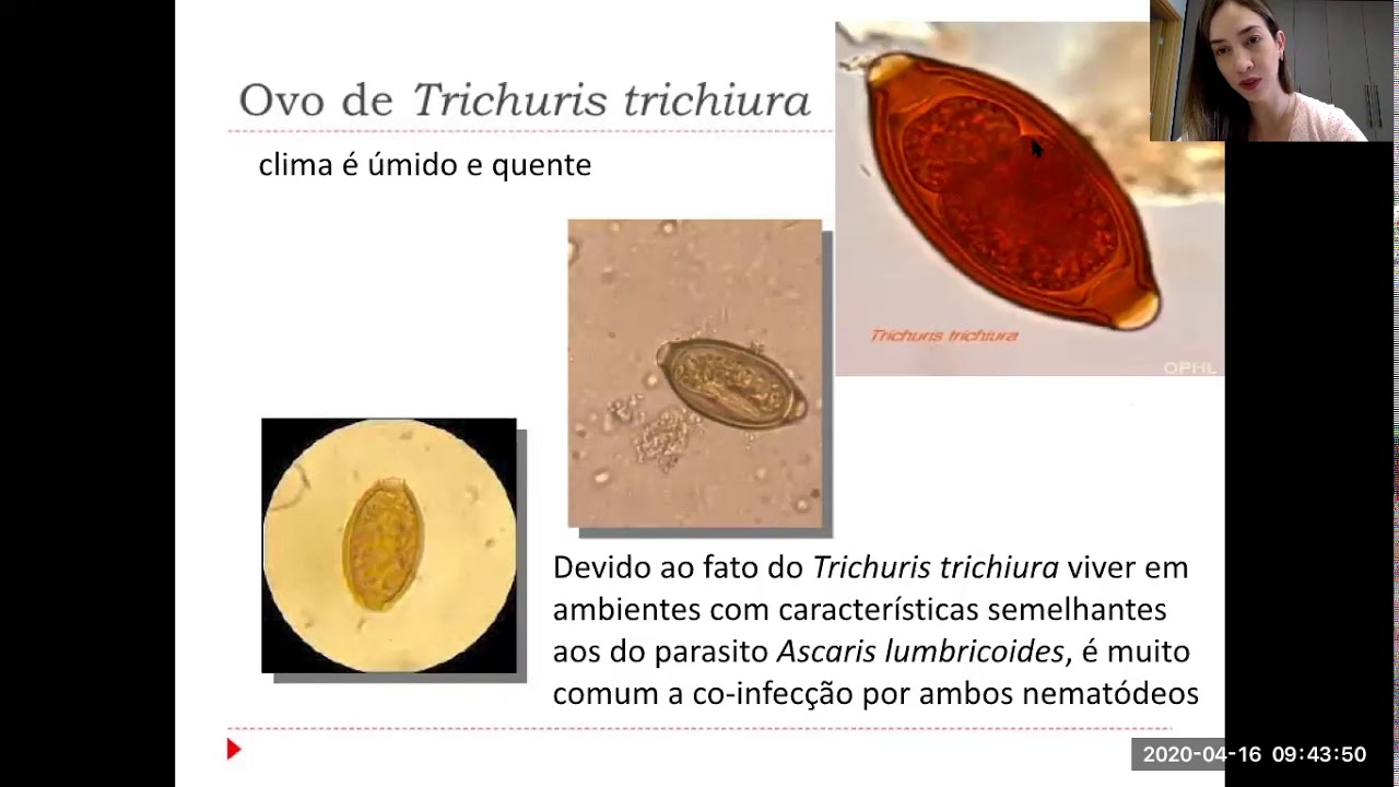 Tricuríase