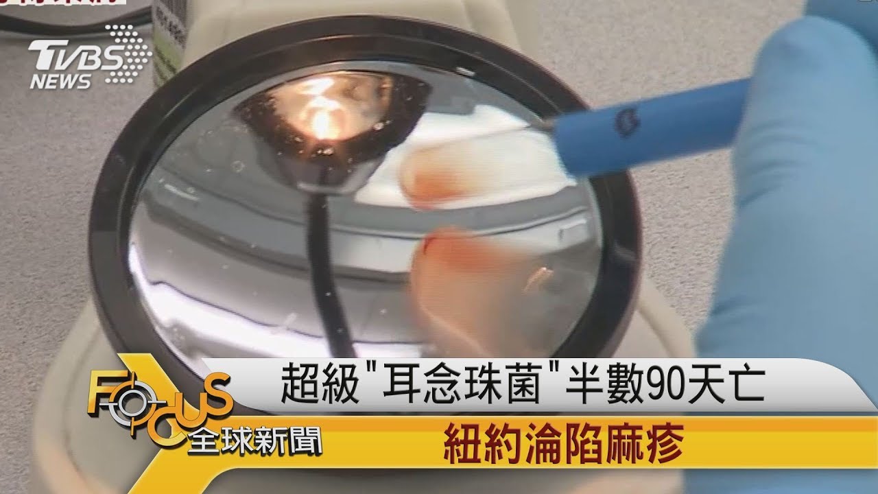 超級「耳念珠菌」半數90天亡 紐約淪陷麻疹