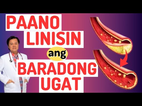 Paano Linisin ang Baradong Ugat. Alamin ang Senyales ng Blocked Arteries. - By Doc Willie Ong