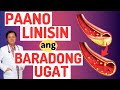 Paano Linisin Ang Baradong Ugat Alamin Ang Senyales Ng Blocked Arteries By Doc Willie Ong