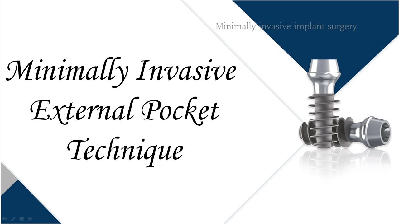 Minimally Invasive External Pocket Technique