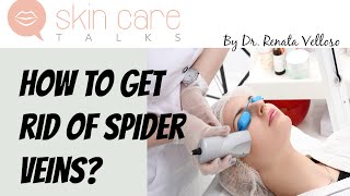 How to get rid of Spider Veins