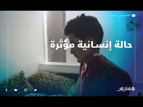 توفيق الجعادي.. شاب مغربي يكشف معاناته مع مرض اعوجاج العمود الفقري وهذا طلبه الوحيد