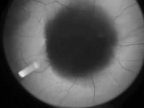 download lagu mp3 mp4 Escopia, download lagu Escopia gratis, unduh video klip Escopia