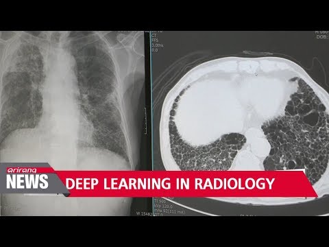 Deep learning applied in radiology to accurately diagnose patients