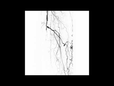 TruePath Left SFA CTO #1