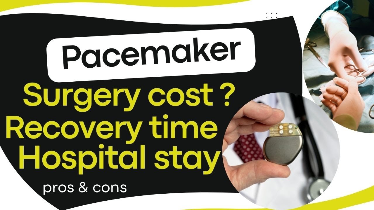 Heart pacemaker surgery cost | recovery time, side effects, success rate of pacemaker surgery - YouTube