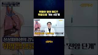 위염이 암이 된다? 위암으로 가는 4단계