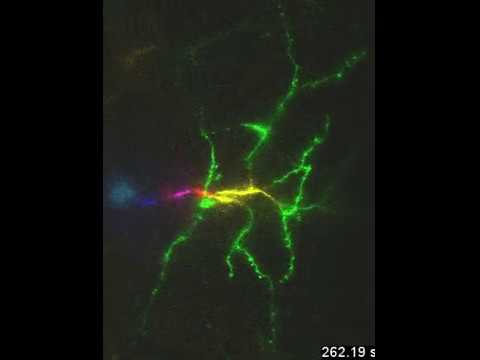 speed of neurons in the brain speed of neurons in the brain